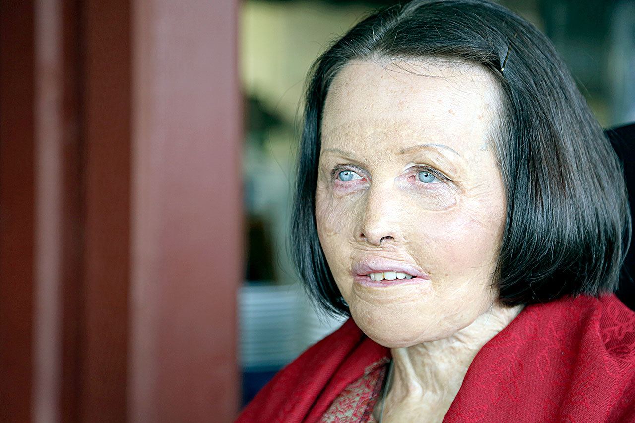 Benefit concert planned for Barbara Gooding in Port Angeles on Saturday