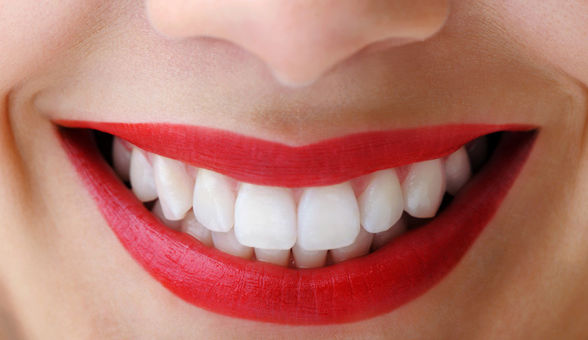 How-to: give stained teeth the flick