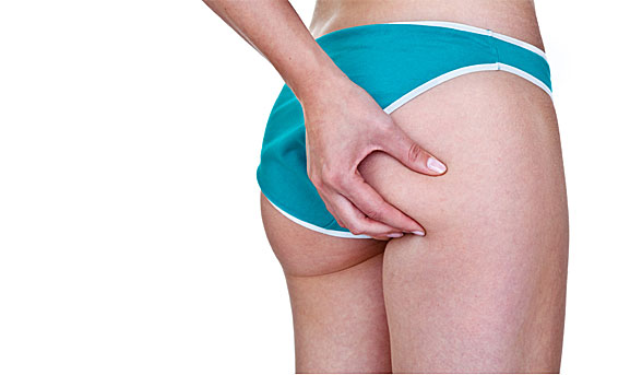 Can walking banish cellulite?