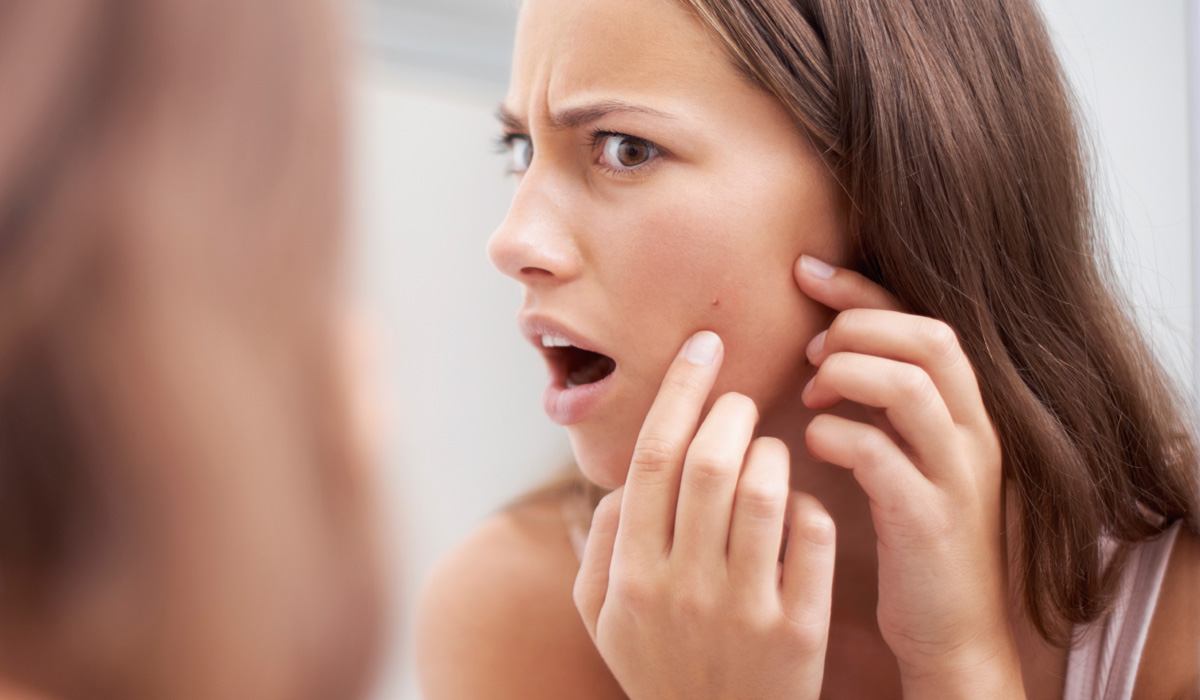 Why am I breaking out?