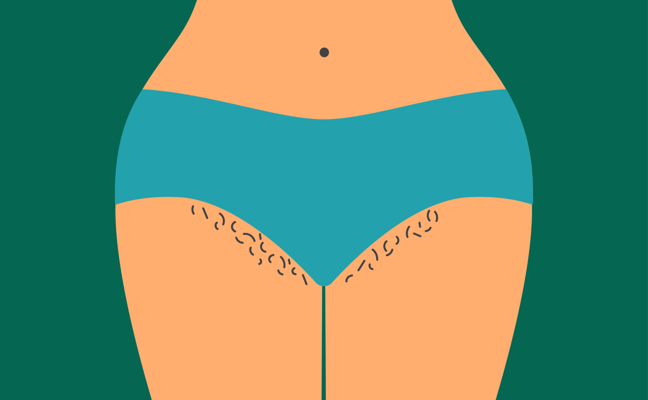 Where is your bikini line?