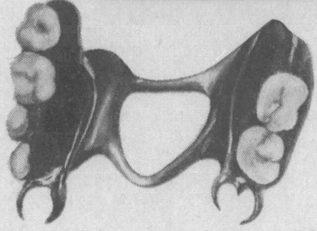 Dental piece found in body discovered at Lake Crescent.